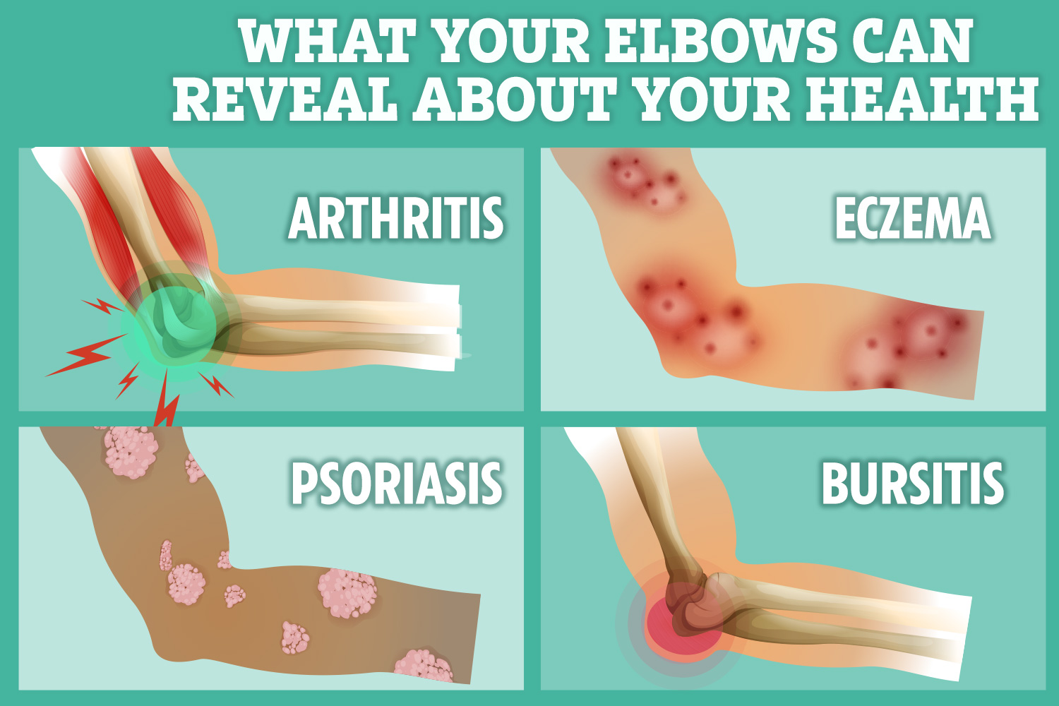 From dry patches to aches and pains – what your ELBOWS can reveal about your health and when to worry