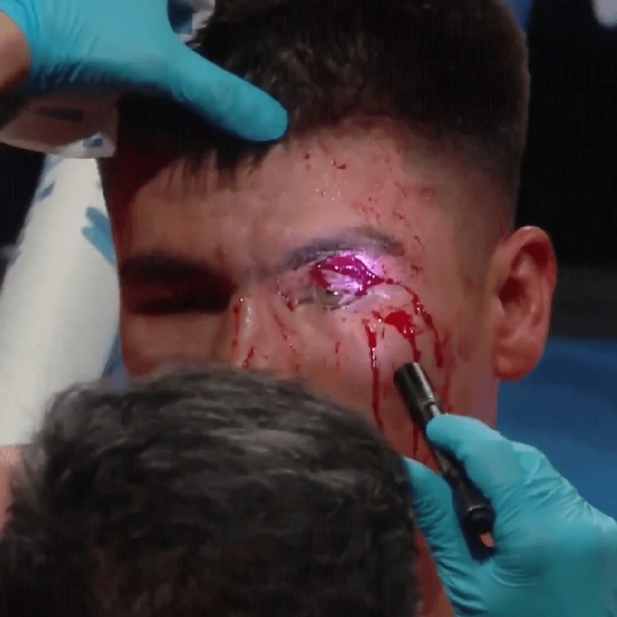 Fight brutally CALLED OFF as boxers both suffer gruesome cuts on undercard of Devin Haney vs Ryan Garcia